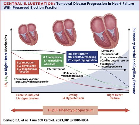 djfhf meaning|Heart Failure With Preserved Ejection Fraction.